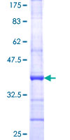 12.5% SDS-PAGE Stained with Coomassie Blue.